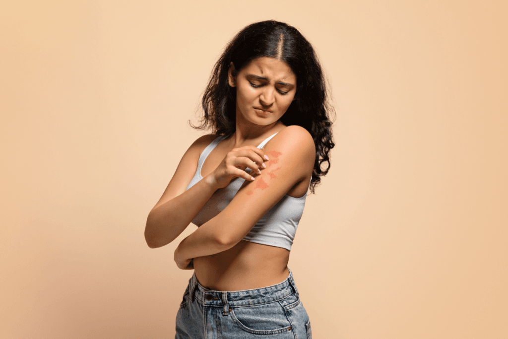 How to Get Rid of Skin Irritation