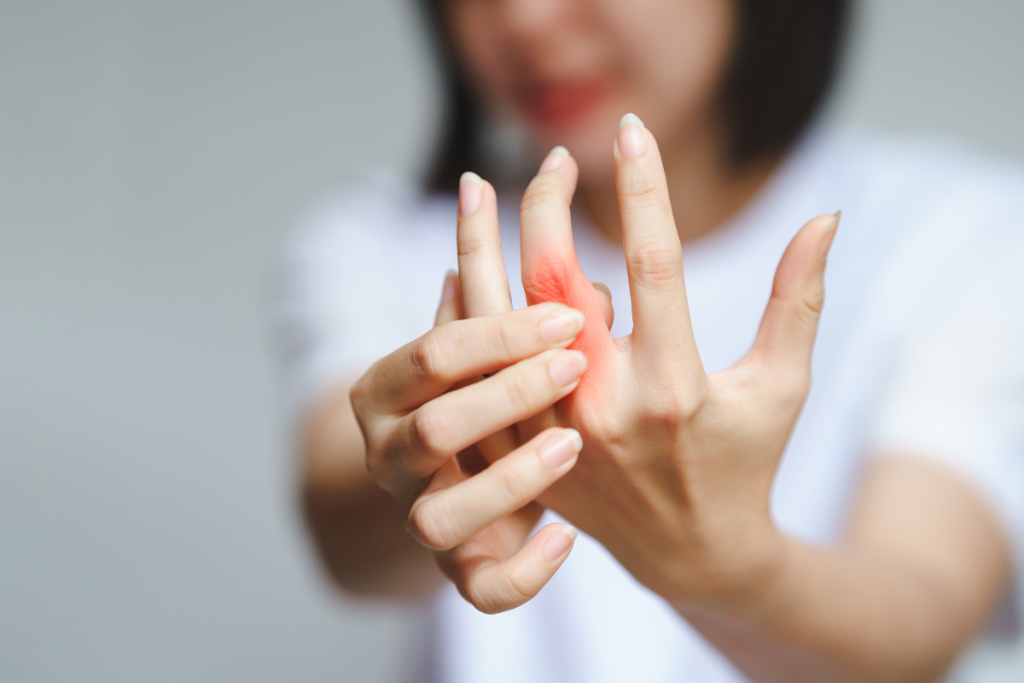 Psoriatic Arthritis Treatment